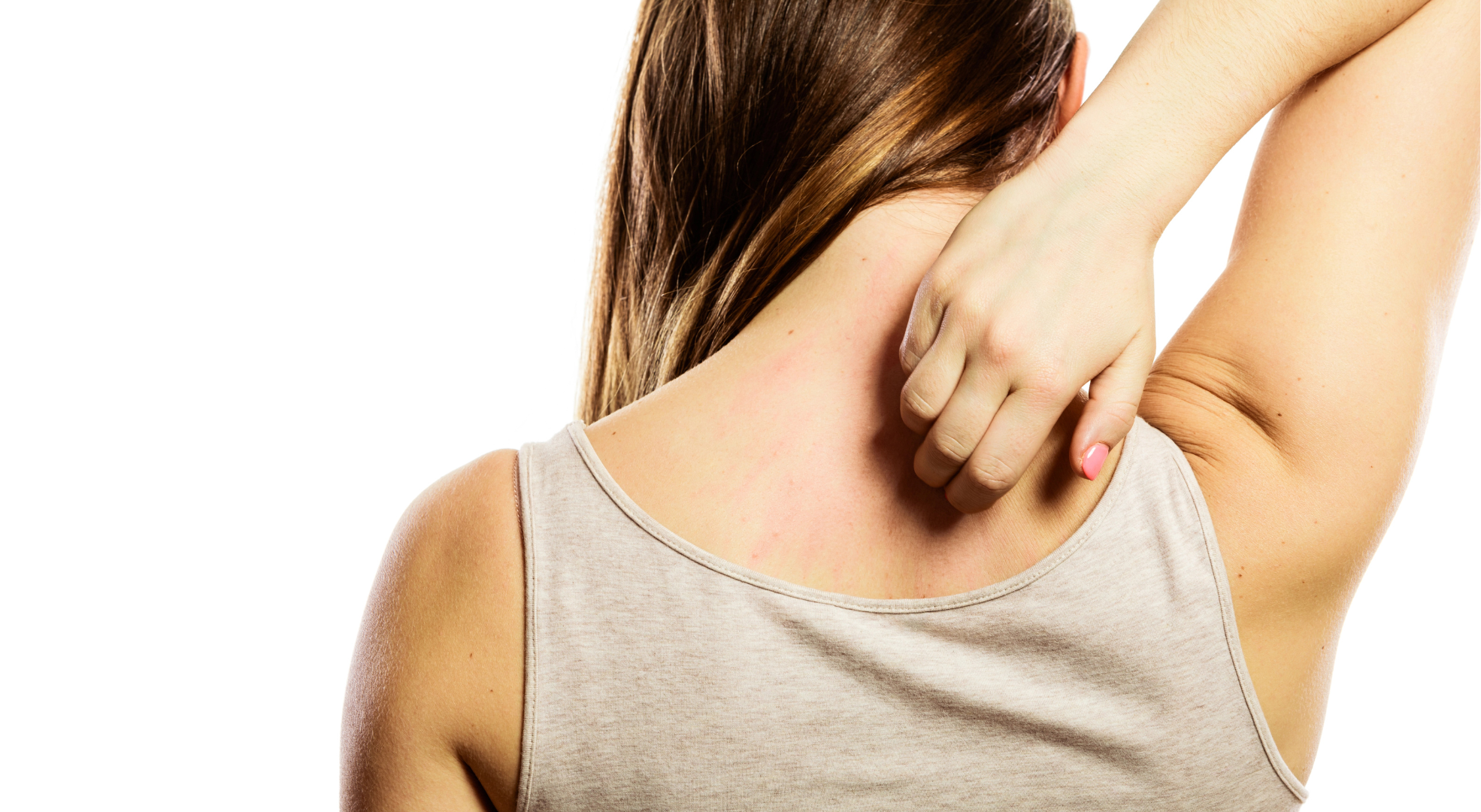 Ist Neurodermitis das gleiche wie Schuppenflechte? Alles, was Sie wissen müssen!