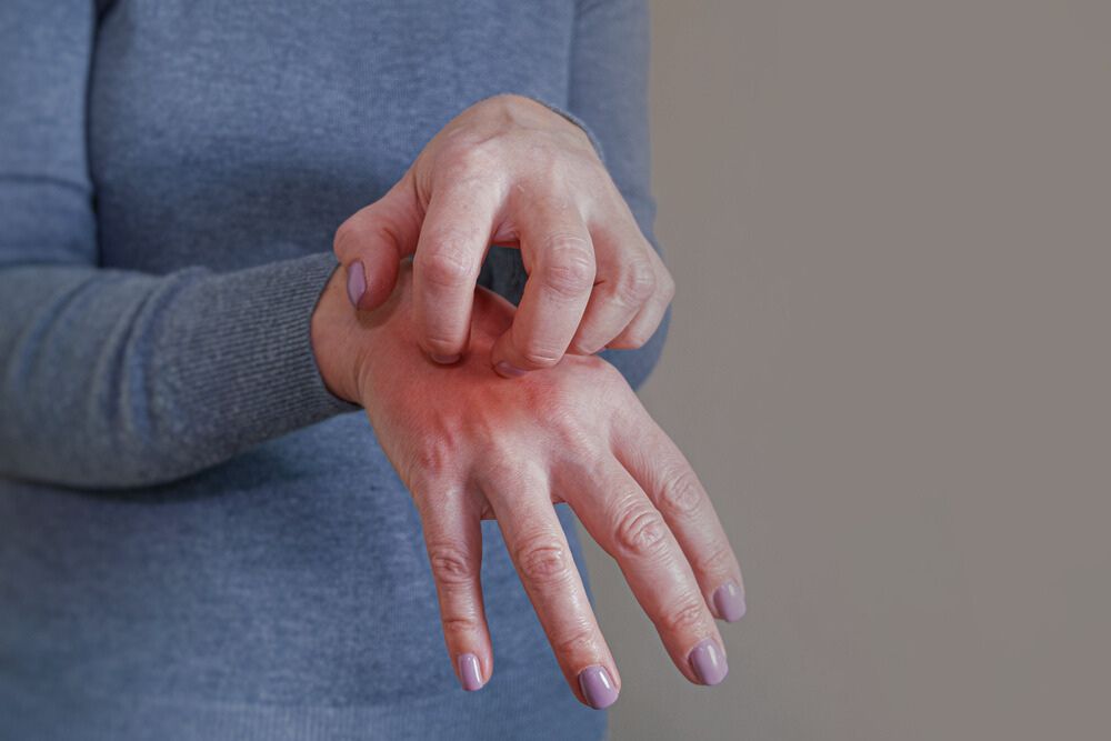 Wie bekommt man Krätze? Ursachen, Symptome und Behandlung – Evolsin-Medical