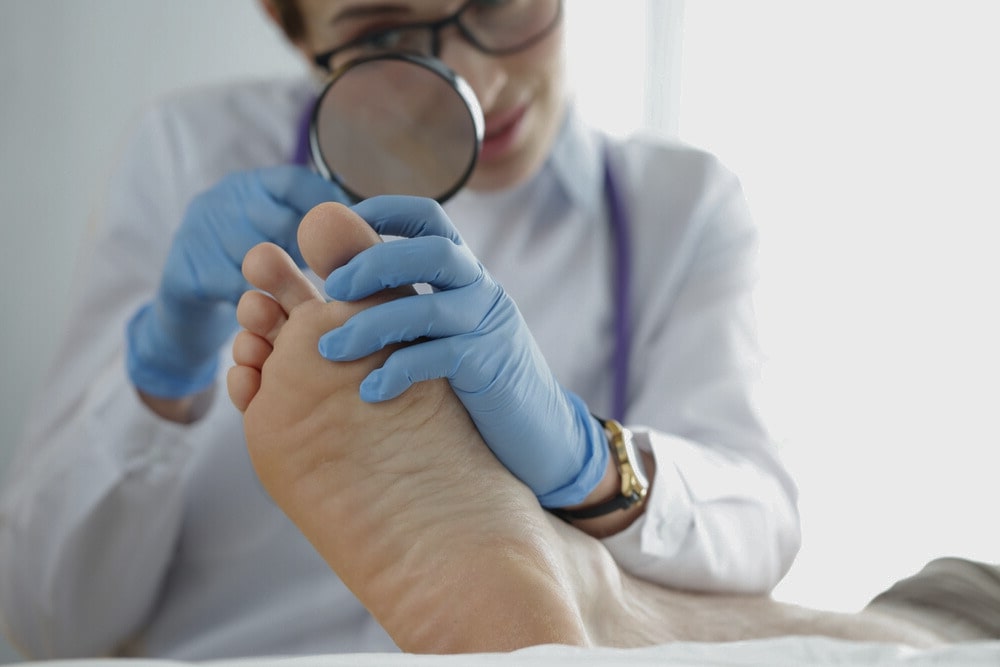 wie lange nagelpilz behandeln