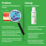 Psoriasis Schuppenflechte Balsam Doppelpack