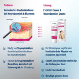 Ekzem & Neurodermitis Creme OHNE Kortison, 50ml