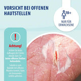 Schuppenflechte & Neurodermitis Creme intensiv, 50ml