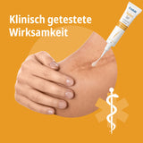 Narben Intensiv-Kur: Narbengel + Narbenpflaster