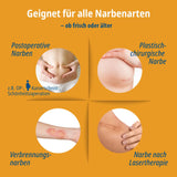 Narbenpflaster Doppelpack