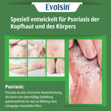Psoriasis Hautpflege Set – Balsam & Lotion