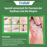 Psoriasis Intensiv Bundle (Balsam + Lotion + Shampoo)