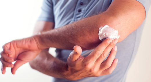 Psoriasis-Schub: Wie ein Balsam gereizte Haut wirklich beruhigen kann