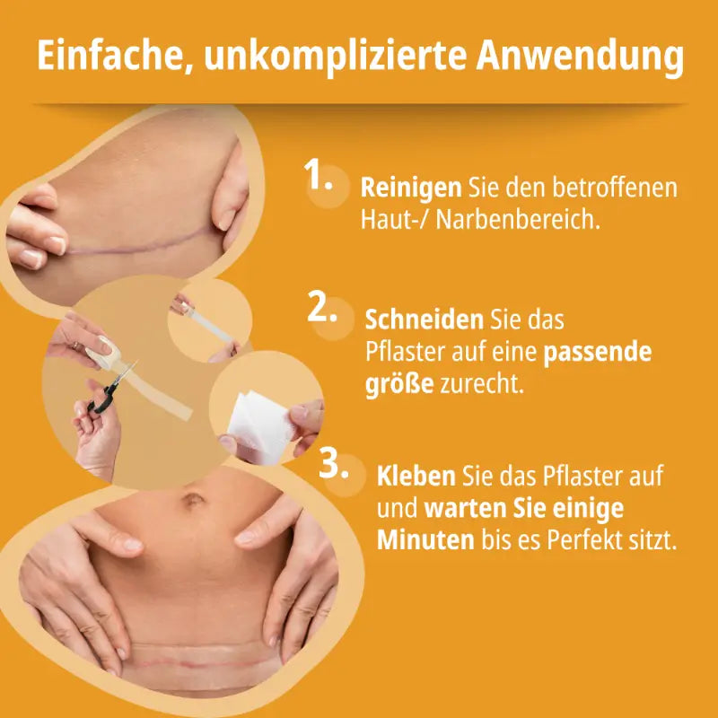 Anwendung des Evolsin Silikon-Narbenpflasters bei der Narbenbehandlung