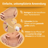 Anwendung des Evolsin Silikon-Narbenpflasters bei der Narbenbehandlung