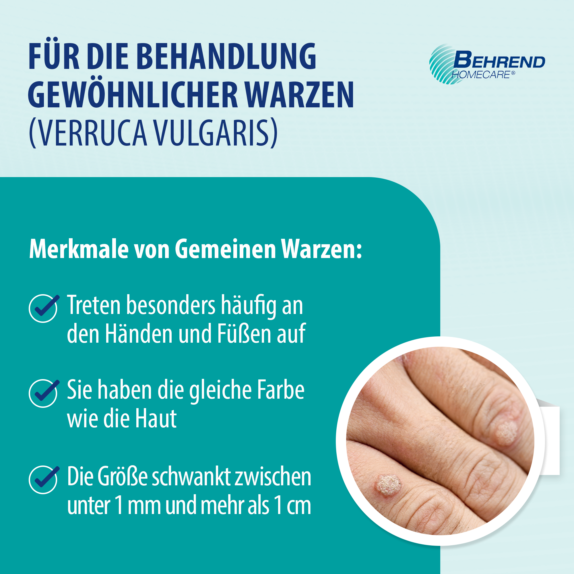 Warzenmittel, 2x2ml