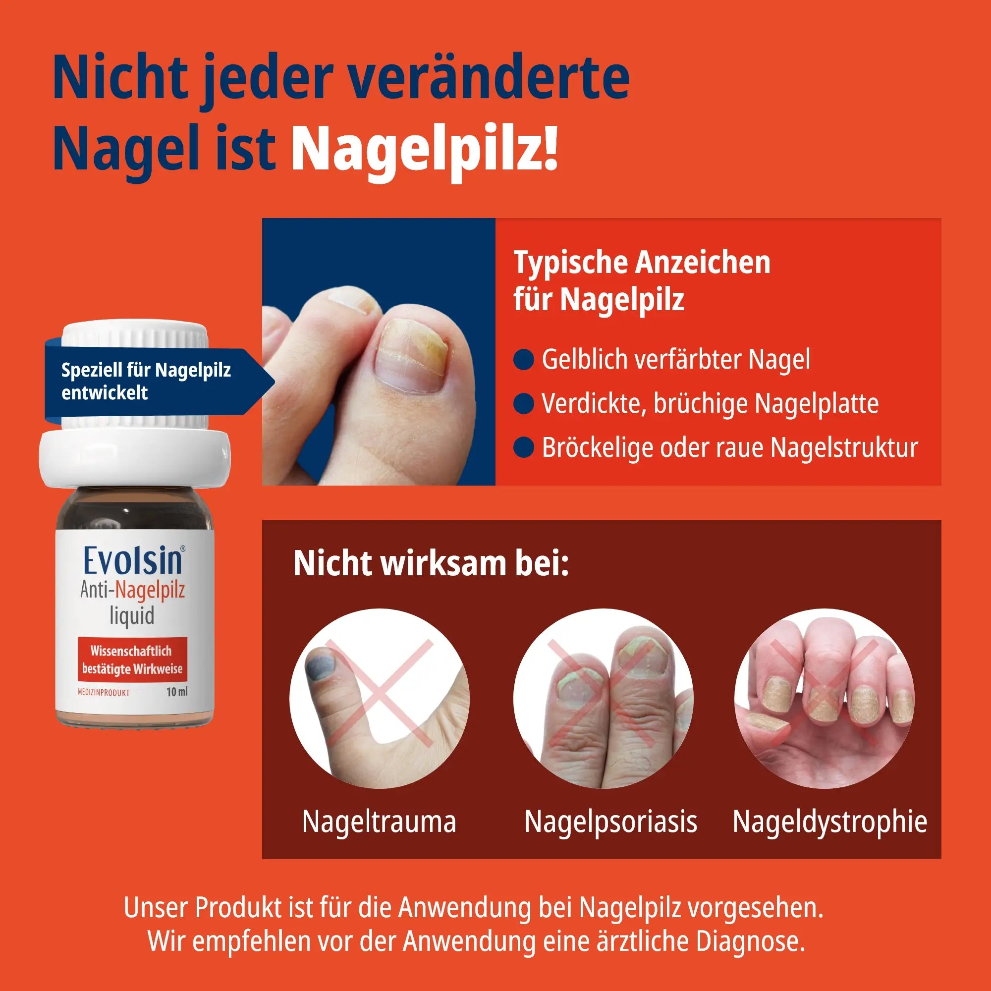 Anti Nagelpilz Liquid