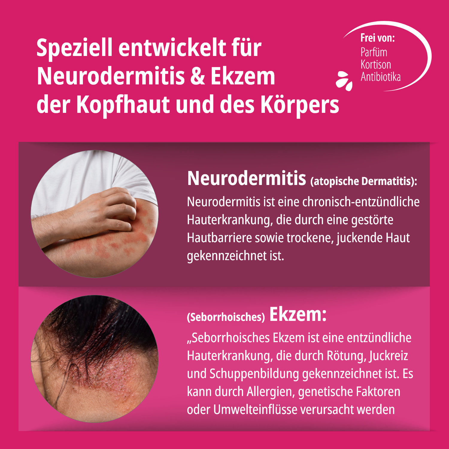 Ekzem & Neurodermitis Creme OHNE Kortison, 50ml
