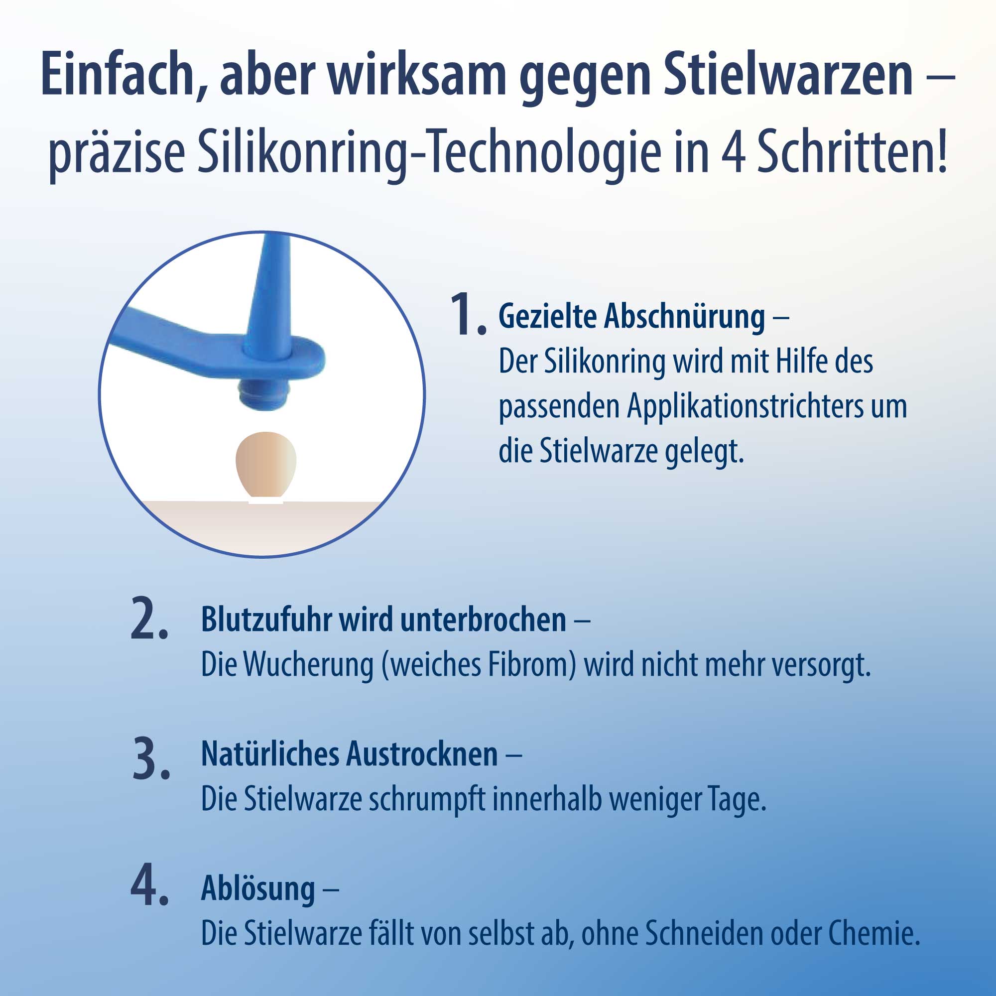 Anti Stielwarze