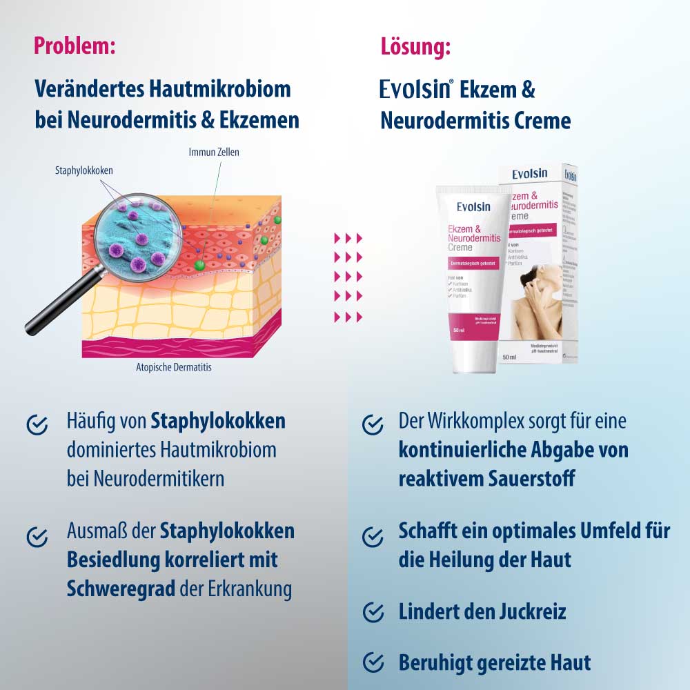 Ekzem & Neurodermitis Creme OHNE Kortison, 50ml