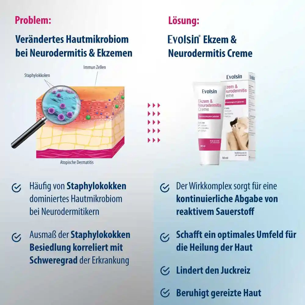 Ekzem & Neurodermitis Creme OHNE Kortison, 50ml