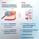 Ekzem & Neurodermitis Creme OHNE Kortison, 50ml