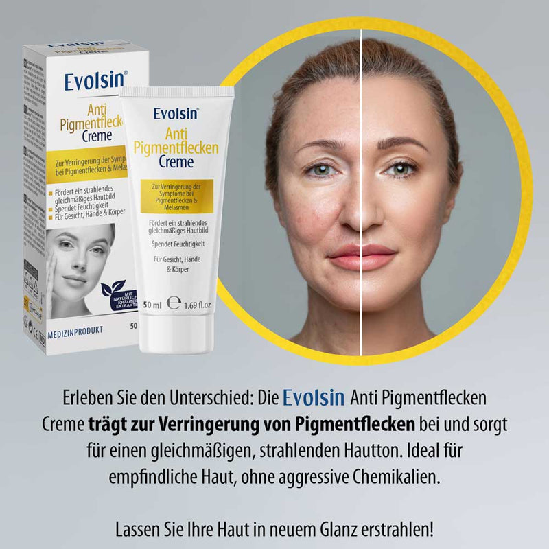 Anti-Pigmentflecken Creme