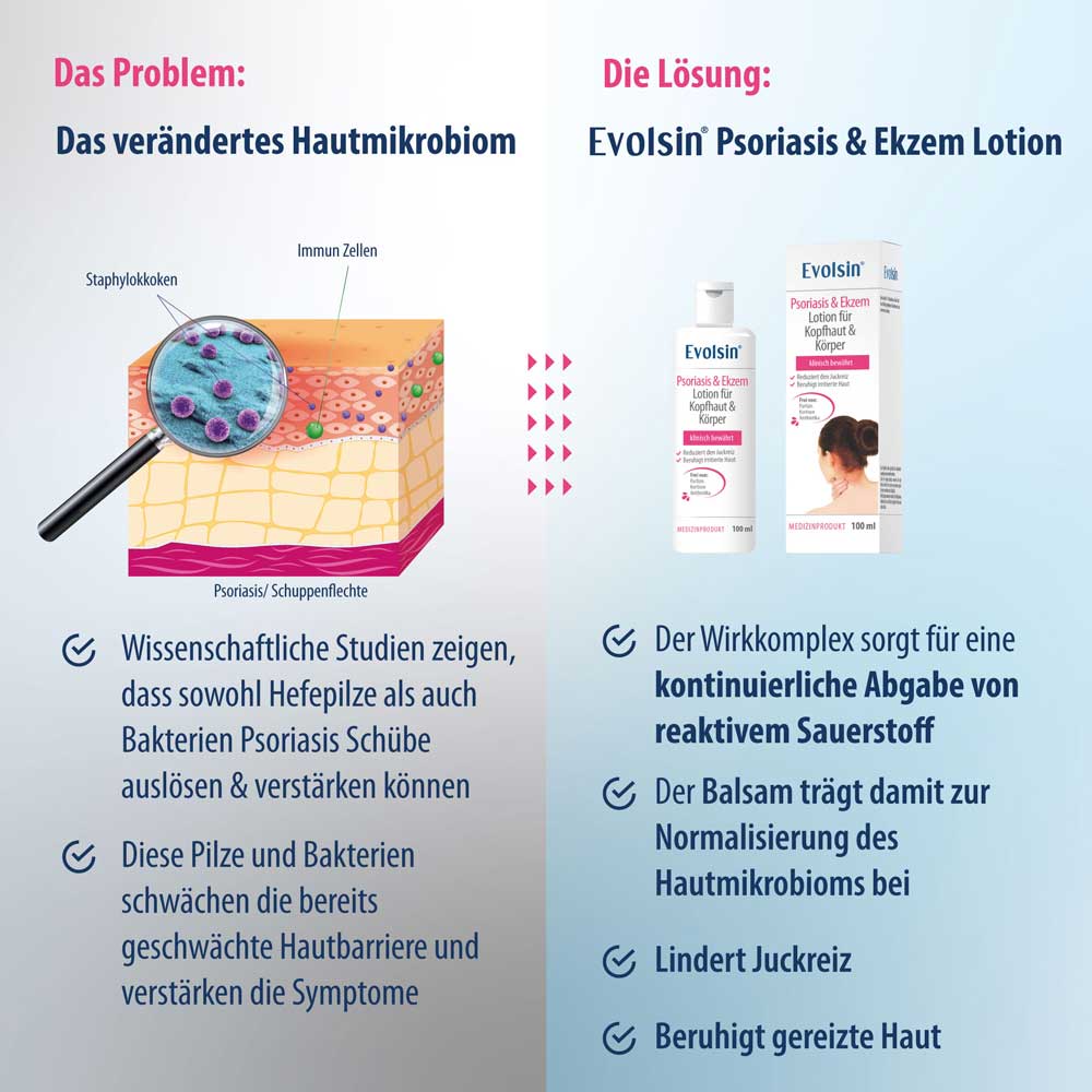 Psoriasis & Ekzem Lotion für Kopfhaut und Körper