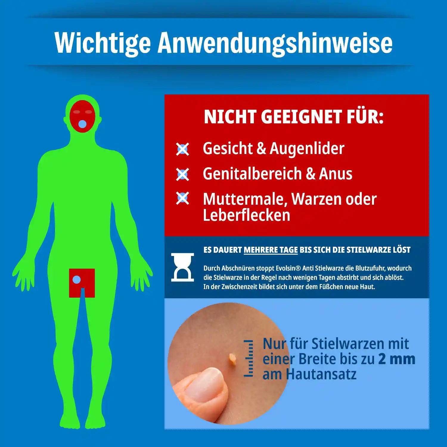 Anti Stielwarze