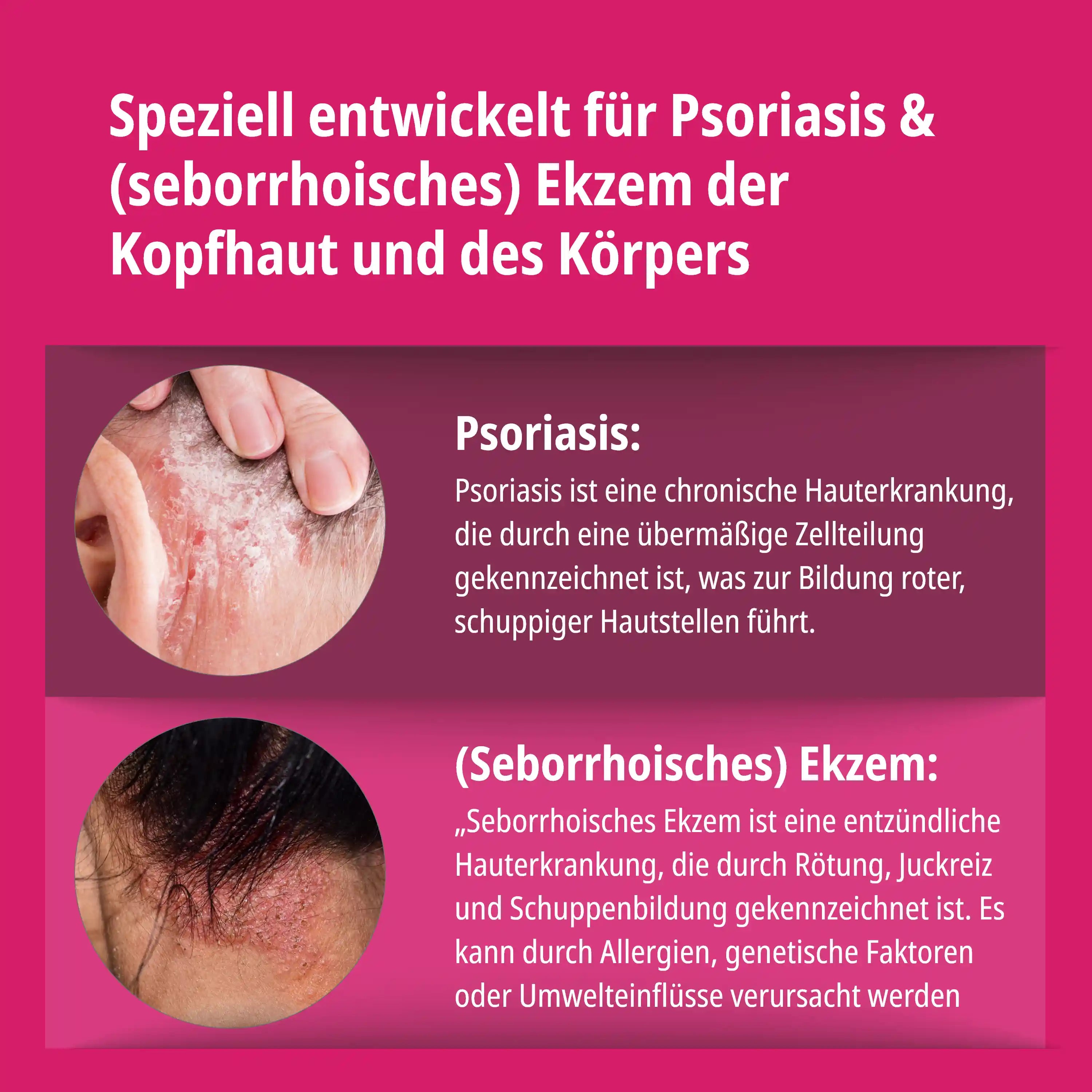 Psoriasis & Ekzem Shampoo für Kopfhaut & Körper