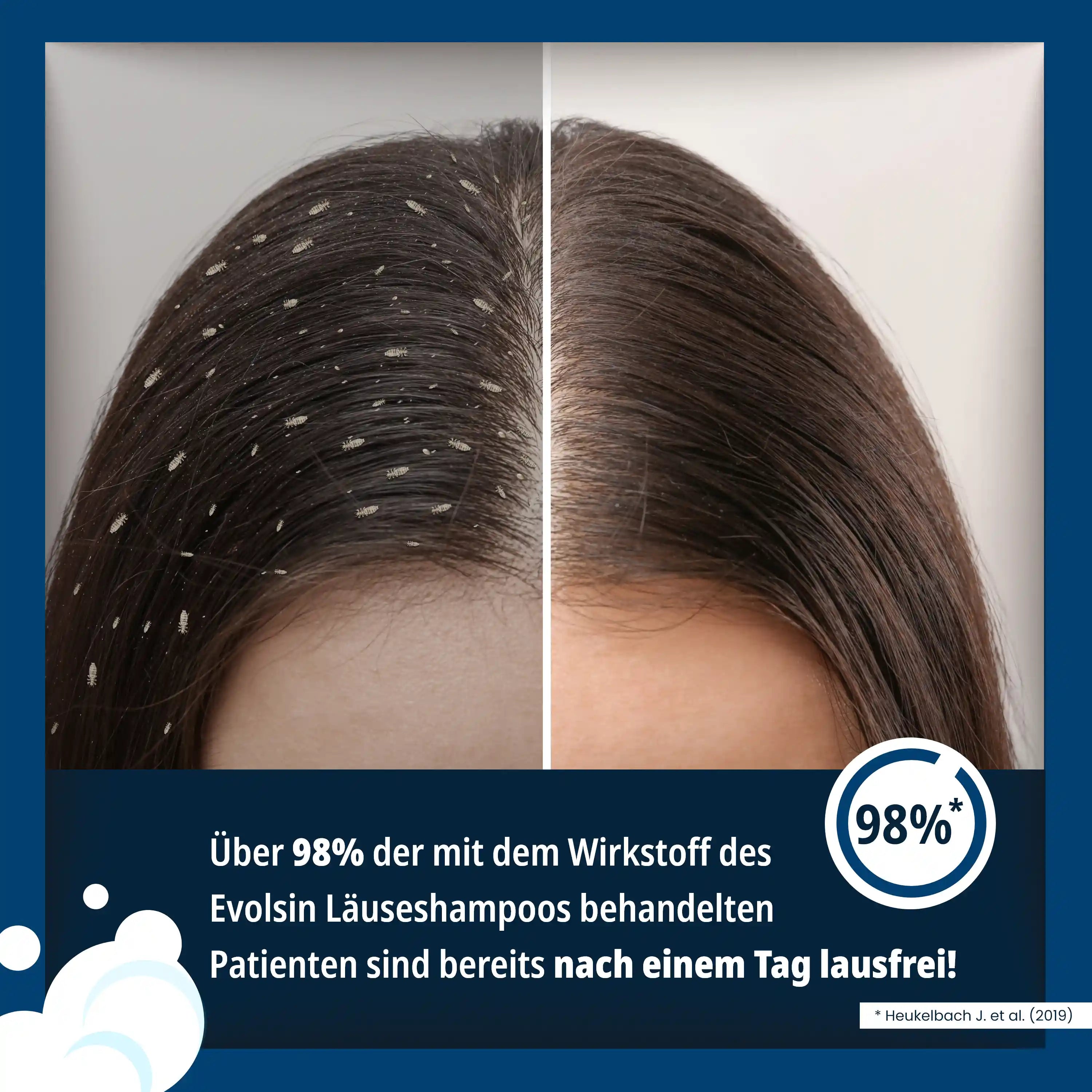Läuseshampoo mit Läusekamm für Erwachsene & Kinder