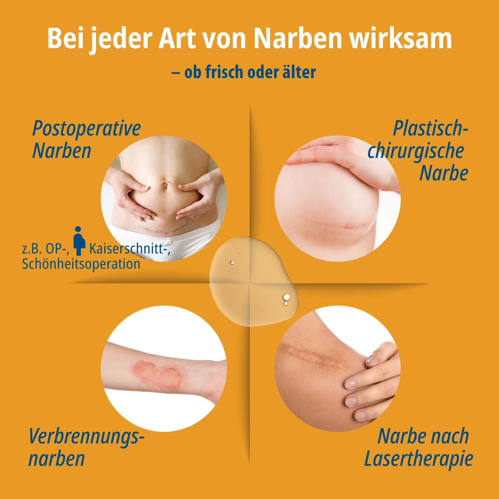 Evolsin Narben-Gel Doppelpack (2x20g) für Kinder & Erwachsene