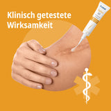 Narben Intensiv-Kur: Narbengel + Narbenpflaster