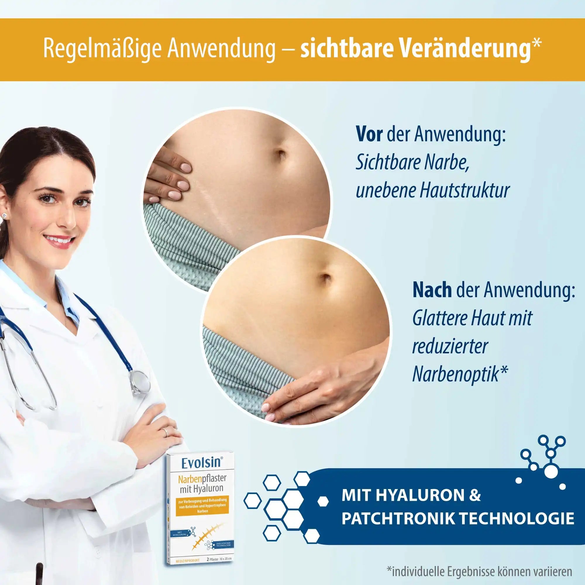 Narbenpflaster mit Hyaluron - 2 Stück