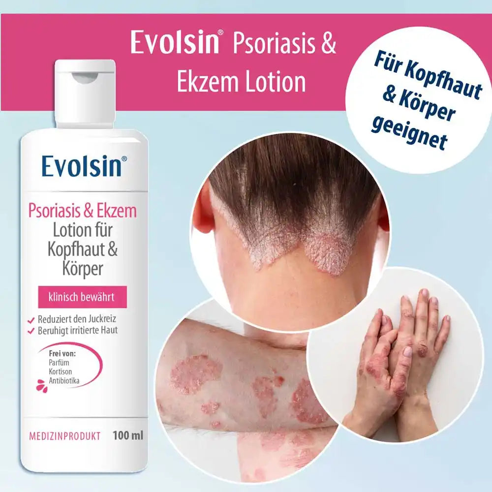 Psoriasis & Ekzem Lotion für Kopfhaut und Körper