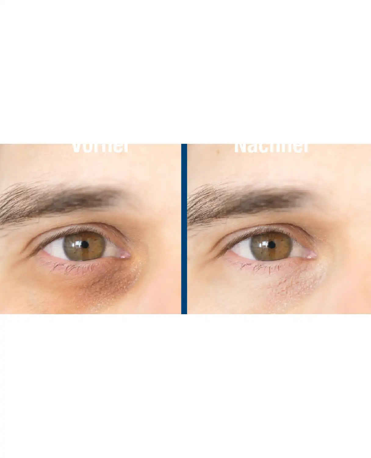 Augen Kur Premium Konzentrat Roll-On, 10ml