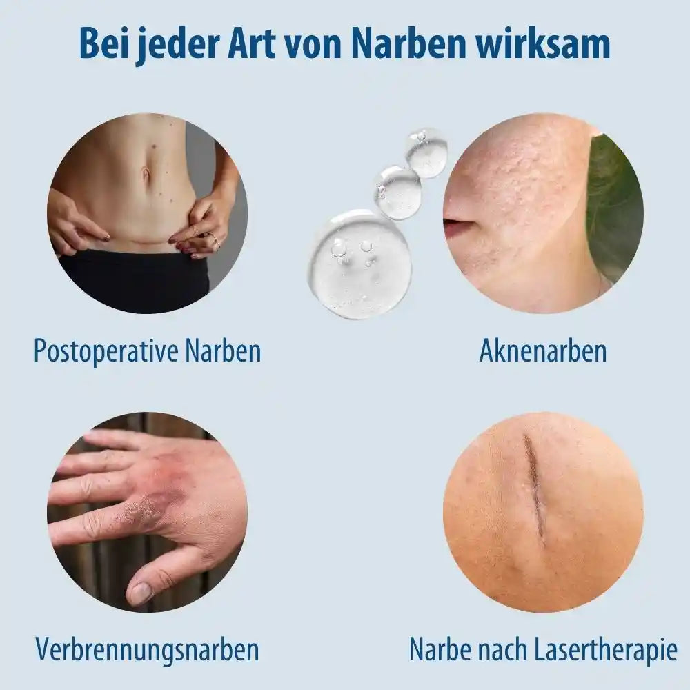 Evolsin Narben-Gel 20g für Kinder & Erwachsene - Narbensalbe