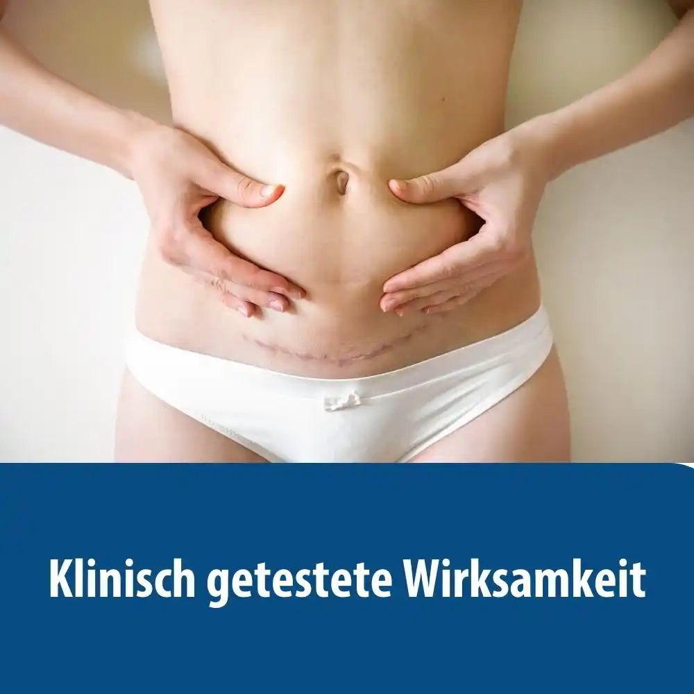 Evolsin Narben-Gel 20g für Kinder & Erwachsene - Narbensalbe