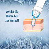 Warzenvereiser Spray